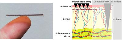 ELSAH (electronic smart patch system for wireless monitoring of molecular biomarkers for healthcare and wellbeing): definition of possible use cases